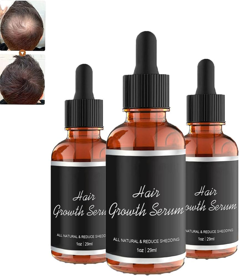 Hair grouth serum